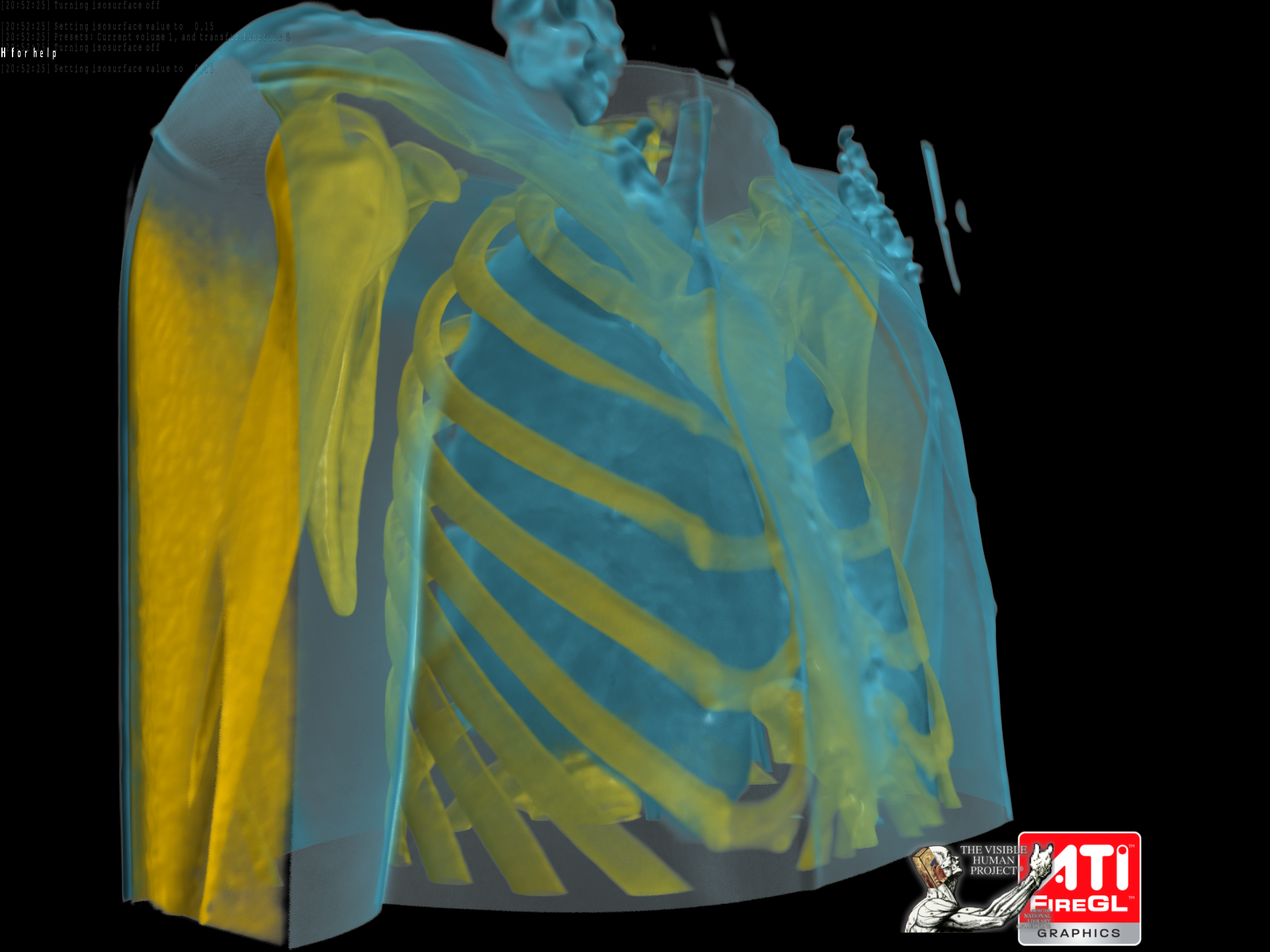 FireGL™ V8600 PCI-Express Real-Time Demos - Medical Visualization